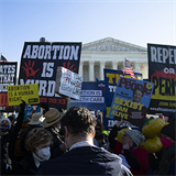 U.S. Supreme Court hears arguments in abortion case